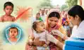 31 अगस्त तक चलेगा खसरा-रूबैला टीकाकरण अभियान, सभी बच्चों को टीका देने का निर्देश