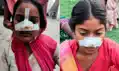 पति ने दांत से पत्नी की नाक काटी तो सास ने दामाद की बहन की भी नाक काटकर लिया ‘बदला’