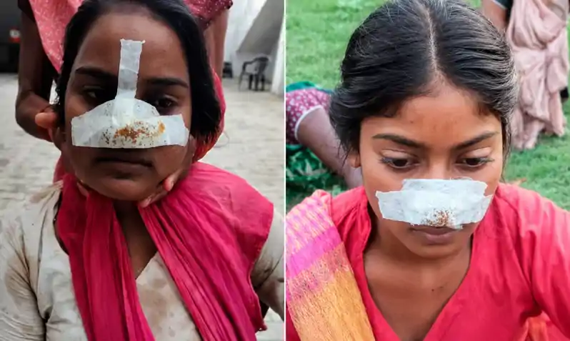 पति ने दांत से पत्नी की नाक काटी तो सास ने दामाद की बहन की भी नाक काटकर लिया ‘बदला’ पति ने दांत से पत्नी की नाक काटी तो सास ने दामाद की बहन की भी नाक काटकर लिया ‘बदला’