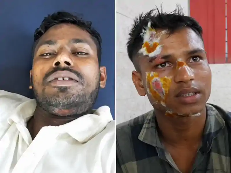 भीषण सड़क हादसा, टेंपो सवार की मौत, चार घायल, मुआवजे की मांग पर NH जाम