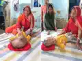  18 महीने का मासूम, डॉक्टर को भी नहीं पता बीमारी, सिर का वजन हुआ 10 किलो, इलाज के लिए मदद की गुहार