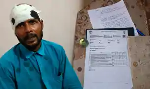 मजदूरी मांगने पर भोरे में मुखिया व उनके भतीजे की दबंगई, मजदूर को बेसमेंट में घसीटकर हथौड़े से पीटा