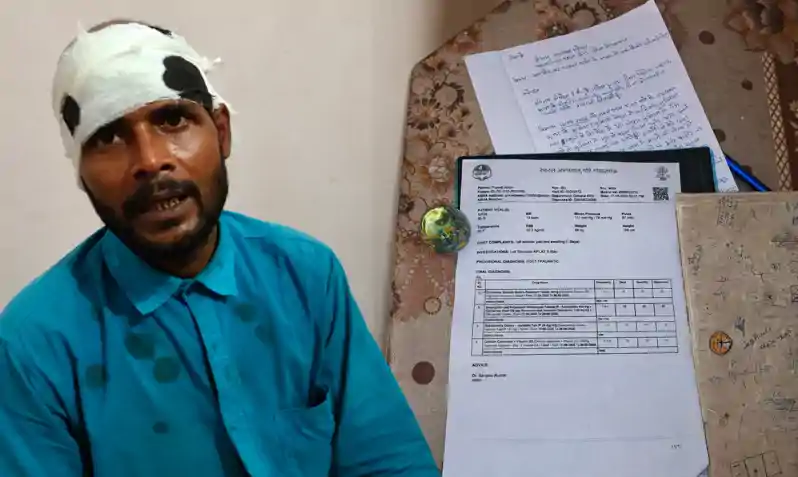 मजदूरी मांगने पर भोरे में मुखिया व उनके भतीजे की दबंगई, मजदूर को बेसमेंट में घसीटकर हथौड़े से पीटा मजदूरी मांगने पर भोरे में मुखिया व उनके भतीजे की दबंगई, मजदूर को बेसमेंट में घसीटकर हथौड़े से पीटा