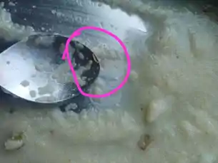 देवघर एम्स में आयुष्मान योजना के मरीज को मिला दूषित भोजन, PMO तक पहुँची शिकायत