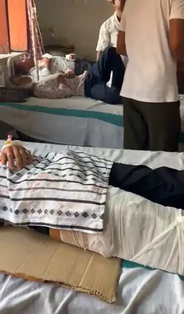 फ्रैक्चर को स्थिर रखने के लिए जुगाड! पैर में लगा दिया कार्टन, अब उठे सवाल