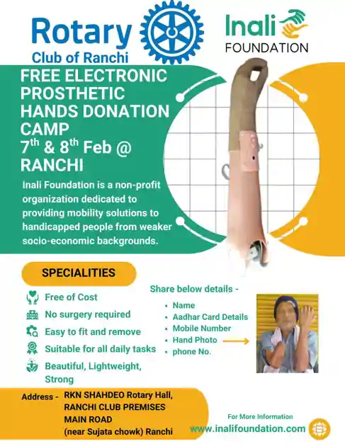 दिव्यांगों के लिए नई उम्मीद, रोटरी क्लब रांची में जल्द लगेगा कृत्रिम हाथ शिविर