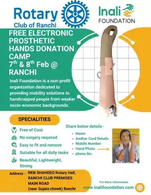 दिव्यांगों के लिए नई उम्मीद, रोटरी क्लब रांची में जल्द लगेगा कृत्रिम हाथ शिविर